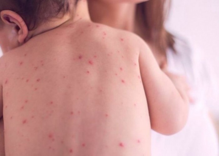 Улаан бурханы өндөржүүлсэн бэлэн байдалтай холбоотойгоор ХӨСҮТ маргааш ажиллана