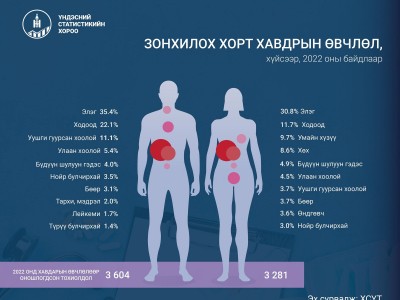 Монгол Улсад хорт хавдрын өвчлөлийн улмаас 26,347 хүн хяналтад байна