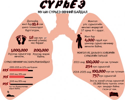 2024 онд сүрьеэ өвчнөөр 415 хүн нас барсан байна
